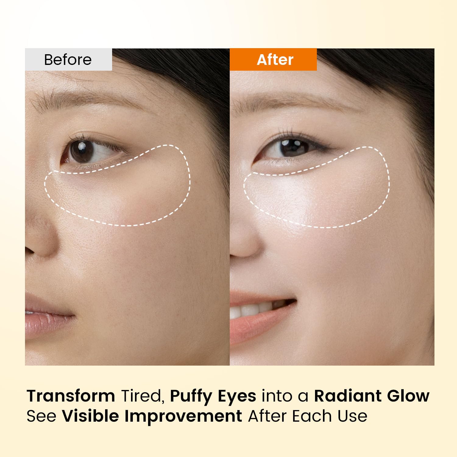 Caffeine Under Eye Patches: 30 Pairs Korean Hydrogel Eye Masks for Dark Circles Puffiness Relief with Niacinamide Hyaluronic Acid - Undereye Brightening Hydrating Anti-Wrinkle Treatment