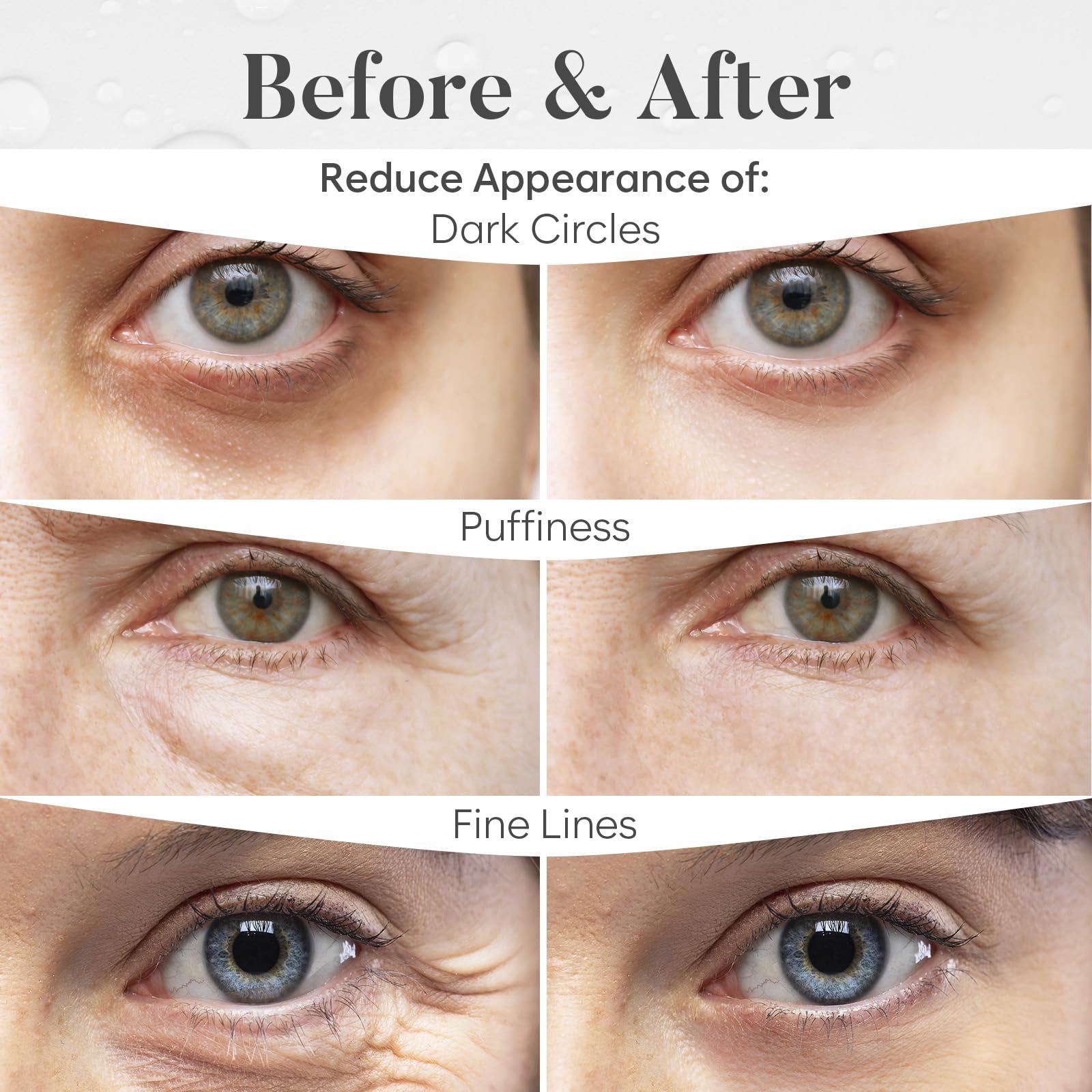 BLOOMORA Variety Under Eye Patches (30 Pairs) - Eye Mask for Dark Circles, Puffy Eyes & Wrinkles - 6 Varieties with Hyaluronic Acid, Green Tea, Rose, 24K Gold, Retinol, Collagen & Caffeine