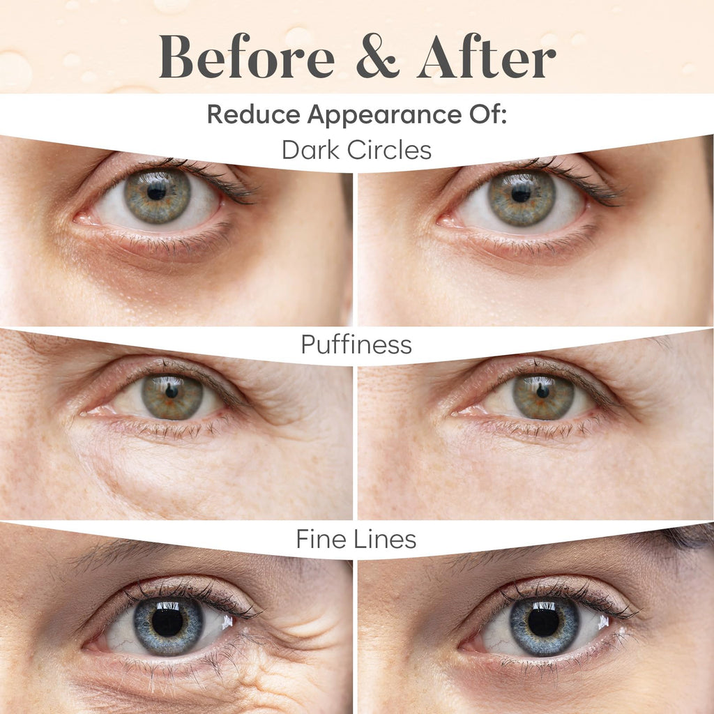 BLOOMORA Variety Under Eye Patches (30 Pairs) - Eye Mask for Dark Circles, Puffy Eyes & Wrinkles - 6 Varieties with Hyaluronic Acid, Green Tea, Rose, 24K Gold, Retinol, Collagen & Caffeine