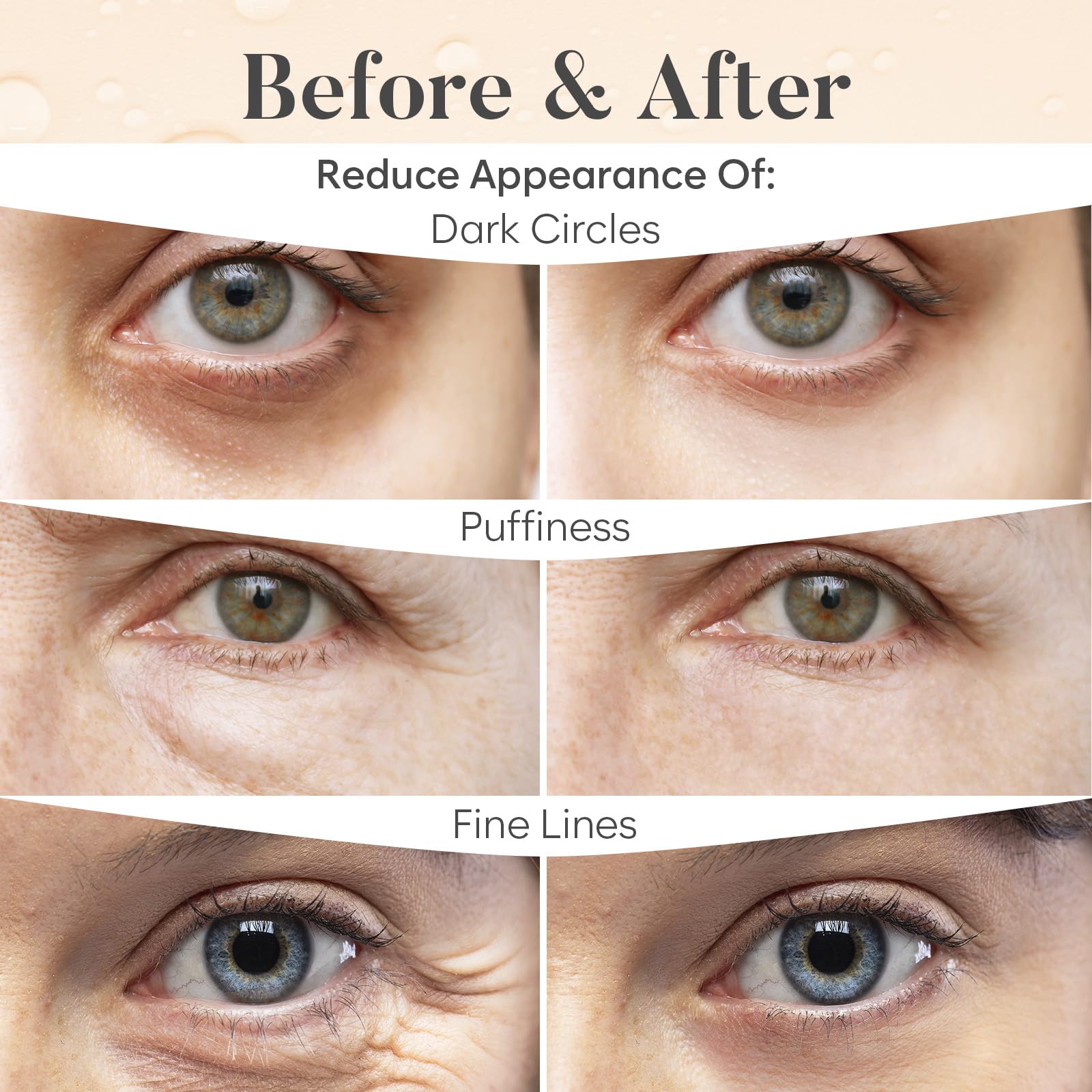 BLOOMORA Variety Under Eye Patches (30 Pairs) - Eye Mask for Dark Circles, Puffy Eyes & Wrinkles - 6 Varieties with Hyaluronic Acid, Green Tea, Rose, 24K Gold, Retinol, Collagen & Caffeine