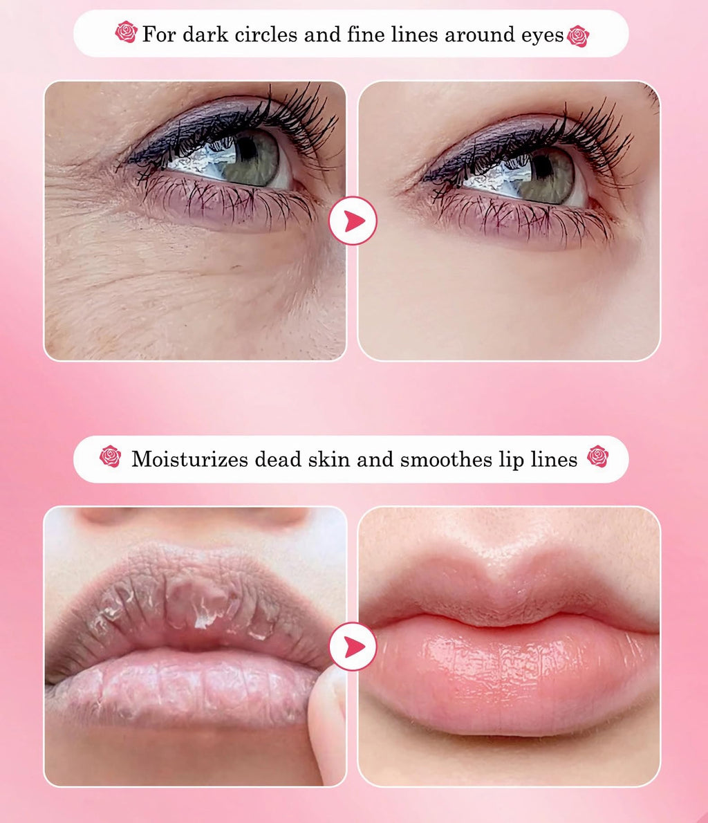 YMEYFAN 20 Pair Under Eye Mask & Lip Mask Skincare Set, Rose Pink Lip Patches & Under Eye Patches for Puffy Eyes, Dark Circles, Dry Lips Lines, Deep Hydrating Moisturizing, Gifts for Mom Women